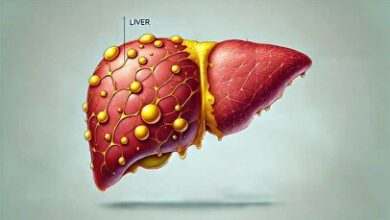 بهترین راهکار برای درمان کبد چرب